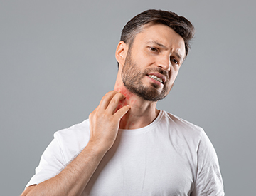 Psoriasis Evalution Test