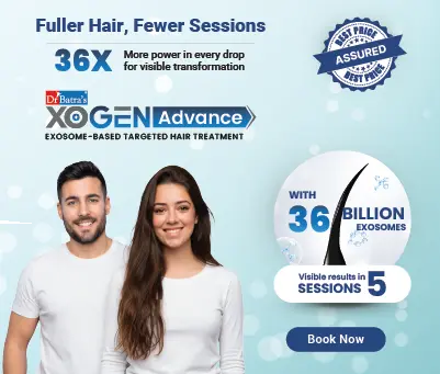XOGEN