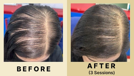 01 Before After