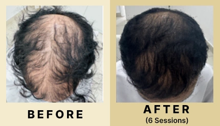 02 Before After