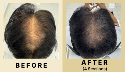 03 Before After
