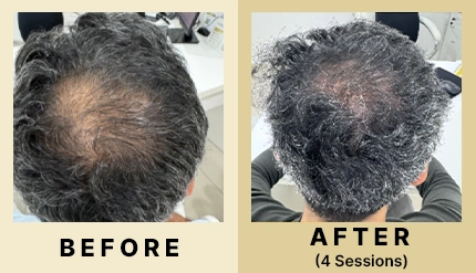 04 Before After