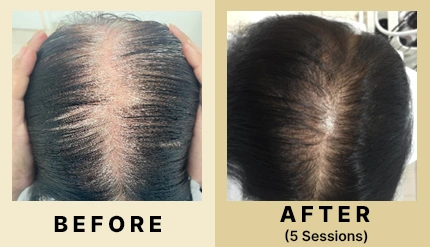 05 Before After