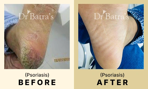 01 Before After