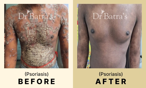 03 Before After