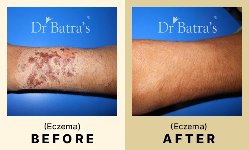 01 Before After