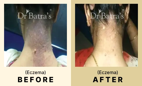 05 Before After