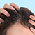 DANDRUFF TREATMENT