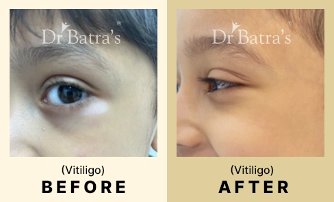 01 Before After