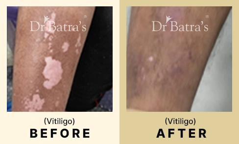 04 Before After