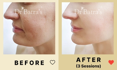 01 Before After