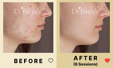 02 Before After