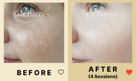 05 Before After
